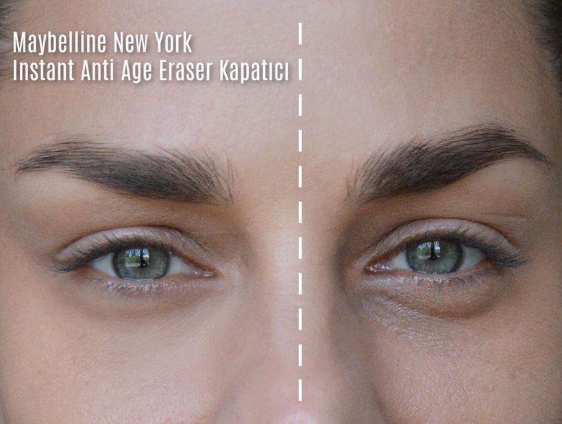 Maybelline Instant Anti Age Eraser Concealer’ın Yoğun Kapatıcı Etkisi