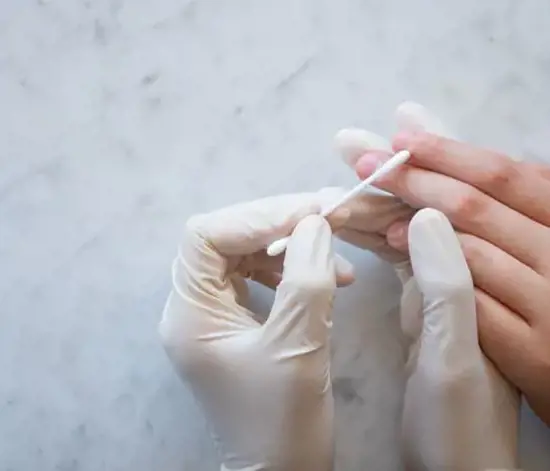 Siğil Nedir? Neden Çıkar?