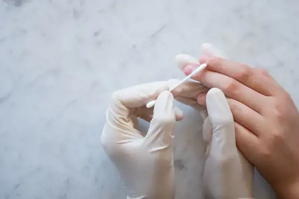 Siğil Nedir? Neden Çıkar?