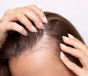 Yeni Uzamaya Başlayan Bebek Saçlar Nasıl Kontrol Altına Alınır?