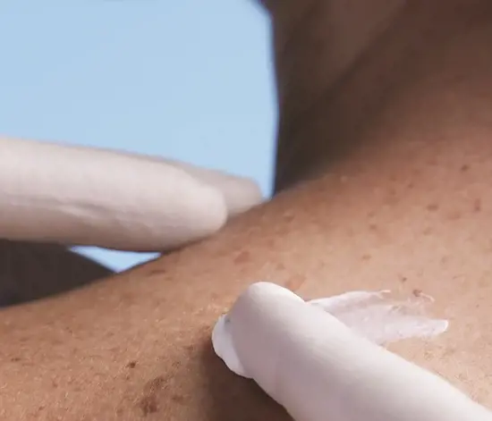 Prof. Dr. Yasemin Atagün’den En Hassas Süreçte Cilt Bakımı Rehberi