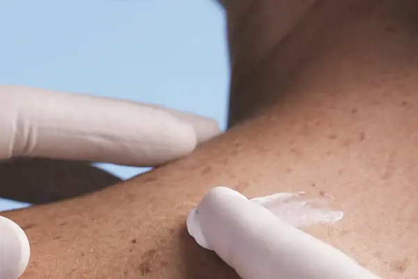 Prof. Dr. Yasemin Atagün’den En Hassas Süreçte Cilt Bakımı Rehberi