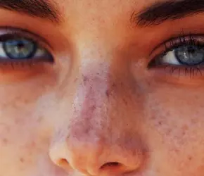 Yazın Leke Giderici Serum ve Leke Kremleri Kullanılır mı?