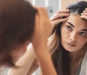 Uzman Görüşüyle: Kafada Sivilce Neden Çıkar?