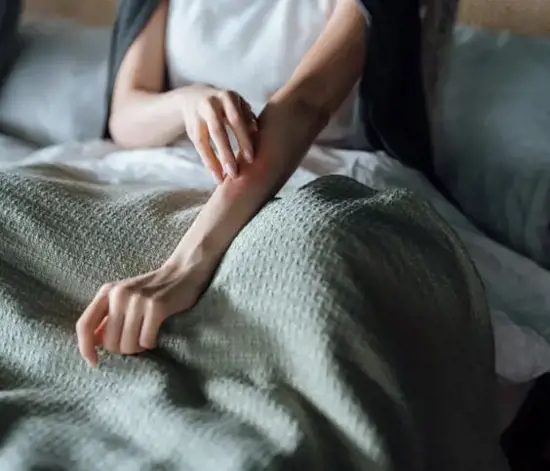 Kaşıntıya Ne İyi Gelir? Evde Kaşıntıya İyi Gelen Doğal Yöntemler