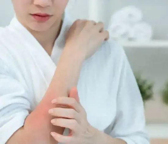 Ürtiker (Kurdeşen) Nedir? Neden Olur?